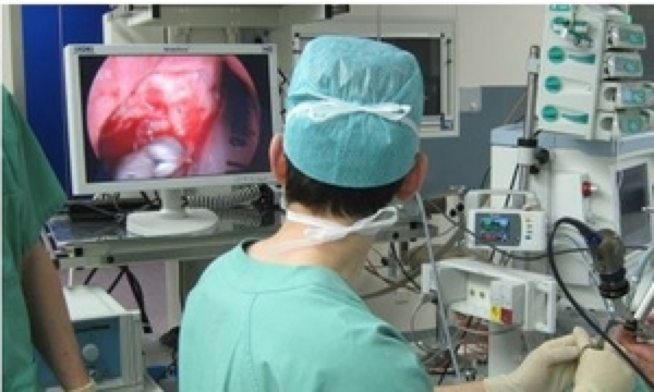 BIOPASS – markerless image-based navigation system for minimally invasive surgery