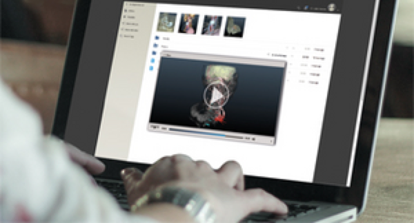 WebSeg – web-based segmentation platform for patient-specific 3D models